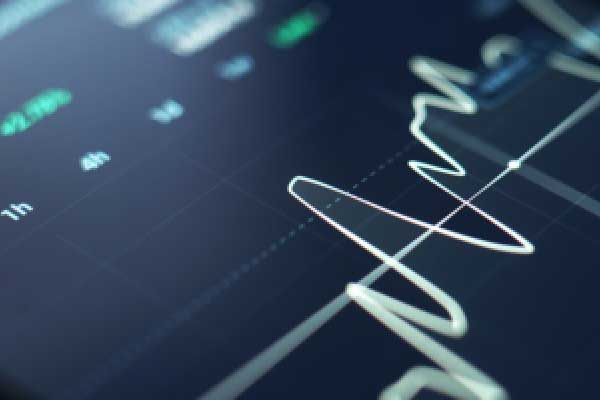 张津镭：非农延期公布，黄金维持高空低多